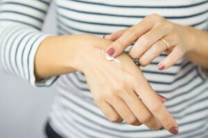 Foto detalle de una mujer curándose una quemadura de la mano. La prevención de riesgos laborales para las empleadas del hogar es vital